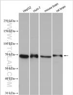 GPAA1 Antibody in Western Blot (WB)