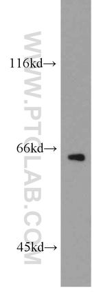 GPAA1 Antibody in Western Blot (WB)