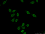 UBE2T/HSPC150 Antibody in Immunocytochemistry (ICC/IF)