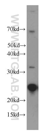 UBE2T/HSPC150 Antibody in Western Blot (WB)