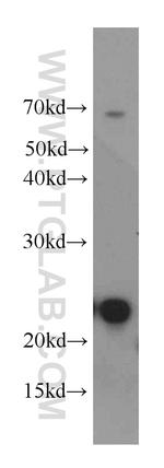 UBE2T/HSPC150 Antibody in Western Blot (WB)