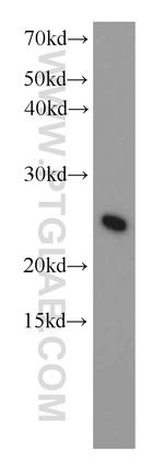 UBE2T/HSPC150 Antibody in Western Blot (WB)