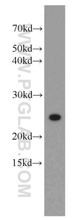 UBE2T/HSPC150 Antibody in Western Blot (WB)