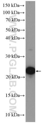 UBE2T/HSPC150 Antibody in Western Blot (WB)