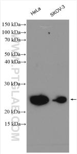 UBE2T/HSPC150 Antibody in Western Blot (WB)