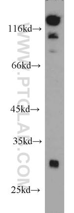 SPIN2B Antibody in Western Blot (WB)