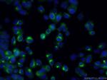 NUMBL Antibody in Immunocytochemistry (ICC/IF)