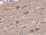 NUMBL Antibody in Immunohistochemistry (Paraffin) (IHC (P))