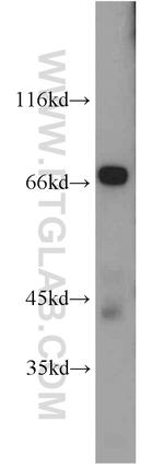 NUMBL Antibody in Western Blot (WB)