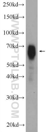 NUMBL Antibody in Western Blot (WB)
