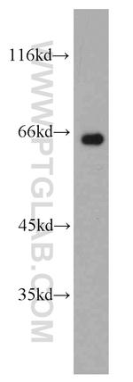 NUMBL Antibody in Western Blot (WB)