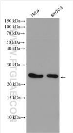 LDOC1 Antibody in Western Blot (WB)