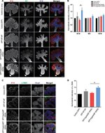 E-cadherin Antibody in Immunohistochemistry (IHC)