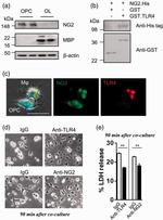 NG2 Monoclonal Antibody (D120.43/D4.11/N143.8/N109.6)