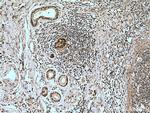 CORO2A Antibody in Immunohistochemistry (Paraffin) (IHC (P))