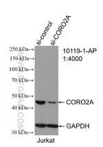 CORO2A Antibody in Western Blot (WB)