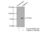 Calpain 6 Antibody in Immunoprecipitation (IP)
