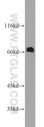 Calpain 6 Antibody in Western Blot (WB)
