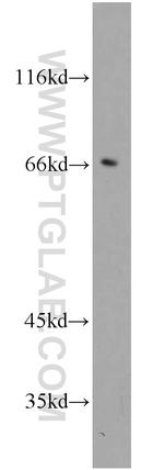 Calpain 6 Antibody in Western Blot (WB)