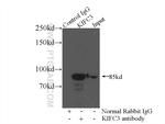 KIFC3 Antibody in Immunoprecipitation (IP)