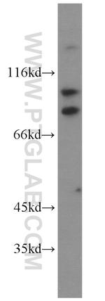 KIFC3 Antibody in Western Blot (WB)
