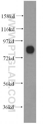 PCDHA2 Antibody in Western Blot (WB)