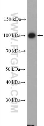 Adaptin Antibody in Western Blot (WB)