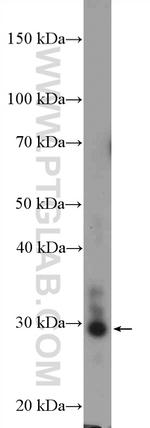 FUSIP1 Antibody in Western Blot (WB)