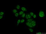 LSM8 Antibody in Immunocytochemistry (ICC/IF)
