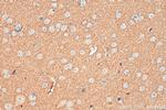VAMP2 Antibody in Immunohistochemistry (Paraffin) (IHC (P))