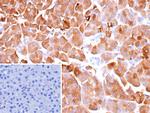 CELA3A/Chymotrypsin like elastase 3A Antibody in Immunohistochemistry (Paraffin) (IHC (P))