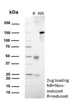 CELA3A/Chymotrypsin like elastase 3A Antibody in SDS-PAGE (SDS-PAGE)