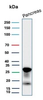 CELA3A/Chymotrypsin like elastase 3A Antibody in Western Blot (WB)