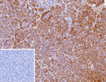 CELA3A/Chymotrypsin like elastase 3A Monoclonal Antibody (CELA3A/12553)