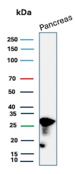 CELA3A/Chymotrypsin like elastase 3A Antibody in Western Blot (WB)