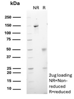 CELA3A/Chymotrypsin like elastase 3A Antibody in SDS-PAGE (SDS-PAGE)