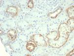 Ksp-Cadherin (Kidney-Specific Cadherin)/CDH16 Monoclonal Antibody (rCDH16/7342)