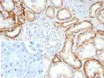 Ksp-Cadherin (Kidney-Specific Cadherin)/CDH16 Recombinant Mouse Monoclonal Antibody (rCDH16/7343)