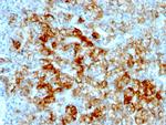 Ksp-Cadherin (Kidney-Specific Cadherin)/CDH16 Monoclonal Antibody (SPM594)