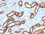Ksp-Cadherin (Kidney-Specific Cadherin)/CDH16 Monoclonal Antibody (rCDH16/1071)