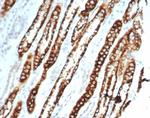 Ksp-Cadherin (Kidney-Specific Cadherin)/CDH16 Recombinant Rabbit Monoclonal Antibody (CDH16/7027R)