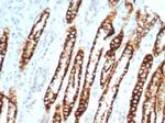 Ksp-Cadherin (Kidney-Specific Cadherin)/CDH16 Recombinant Rabbit Monoclonal Antibody (CDH16/7028R)