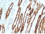 Ksp-Cadherin (Kidney-Specific Cadherin)/CDH16 Recombinant Rabbit Monoclonal Antibody (CDH16/7028R)