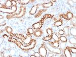 Ksp-Cadherin (Kidney-Specific Cadherin)/CDH16 Recombinant Rabbit Monoclonal Antibody (CDH16/1532R)