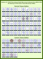 Ksp-Cadherin (Kidney-Specific Cadherin)/CDH16 Recombinant Rabbit Monoclonal Antibody (MSVA-516R)