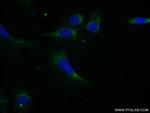 PPP1CB Antibody in Immunocytochemistry (ICC/IF)