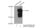 PPP1CB Antibody in Immunoprecipitation (IP)