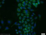 PRKAR2A Antibody in Immunocytochemistry (ICC/IF)