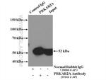 PRKAR2A Antibody in Immunoprecipitation (IP)