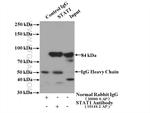 STAT1 Antibody in Immunoprecipitation (IP)